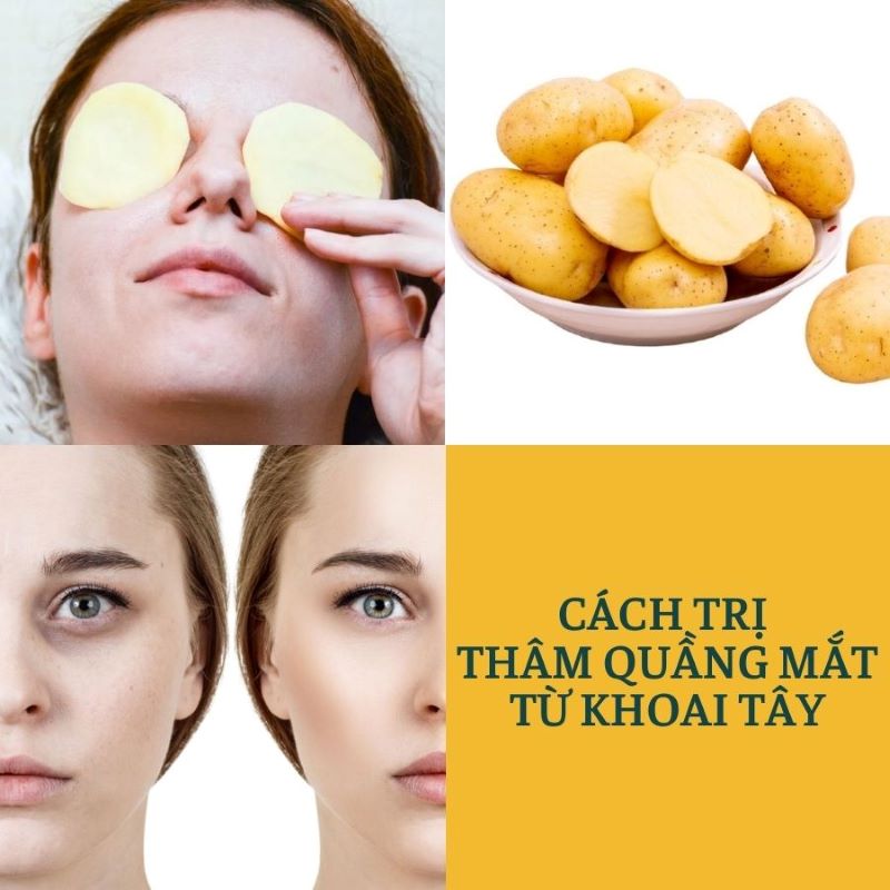 Phương pháp trị thâm mắt tại nhà